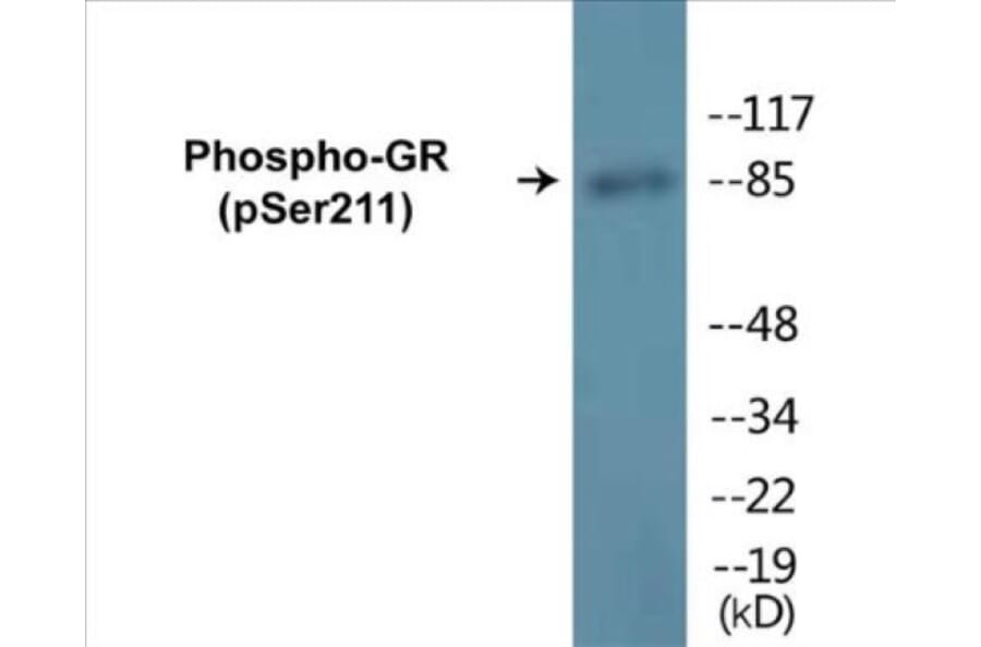 Western Blot - GR (phospho Ser211) Cell Based ELISA Kit (CBP1066) - Antibodies.com