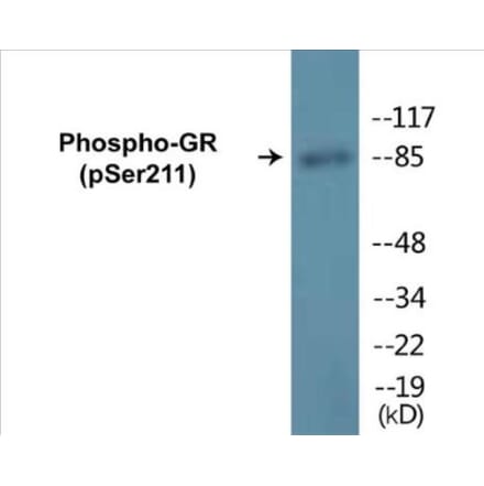 Western Blot - GR (phospho Ser211) Cell Based ELISA Kit (CBP1066) - Antibodies.com