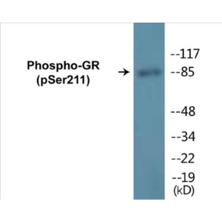 Western Blot - GR (phospho Ser211) Cell Based ELISA Kit (CBP1066) - Antibodies.com