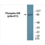 Western Blot - GR (phospho Ser211) Cell Based ELISA Kit (CBP1066) - Antibodies.com