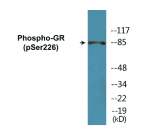 Western Blot - GR (phospho Ser226) Cell Based ELISA Kit (CBP1120) - Antibodies.com