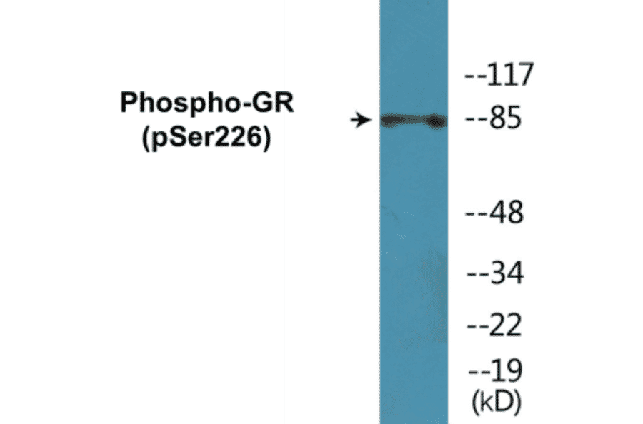 Western Blot - GR (phospho Ser226) Cell Based ELISA Kit (CBP1120) - Antibodies.com