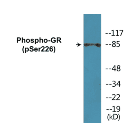 Western Blot - GR (phospho Ser226) Cell Based ELISA Kit (CBP1120) - Antibodies.com