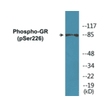 Western Blot - GR (phospho Ser226) Cell Based ELISA Kit (CBP1120) - Antibodies.com