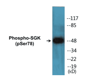Western Blot - SGK (phospho Ser78) Cell Based ELISA Kit (CBP1281) - Antibodies.com