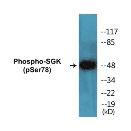 Western Blot - SGK (phospho Ser78) Cell Based ELISA Kit (CBP1281) - Antibodies.com