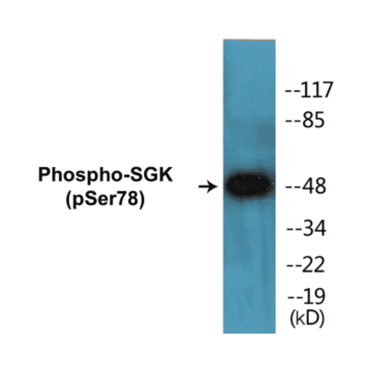 Western Blot - SGK (phospho Ser78) Cell Based ELISA Kit (CBP1281) - Antibodies.com