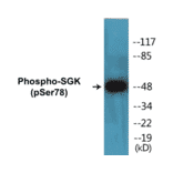 Western Blot - SGK (phospho Ser78) Cell Based ELISA Kit (CBP1281) - Antibodies.com