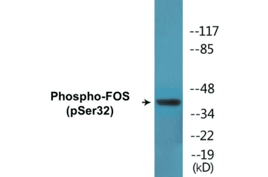 Western Blot - FOS (phospho Ser32) Cell Based ELISA Kit (CBP1781) - Antibodies.com