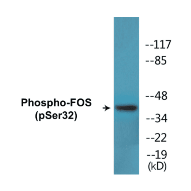 Western Blot - FOS (phospho Ser32) Cell Based ELISA Kit (CBP1781) - Antibodies.com