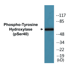 Western Blot - Tyrosine Hydroxylase (phospho Ser40) Cell Based ELISA Kit (CBP1037) - Antibodies.com