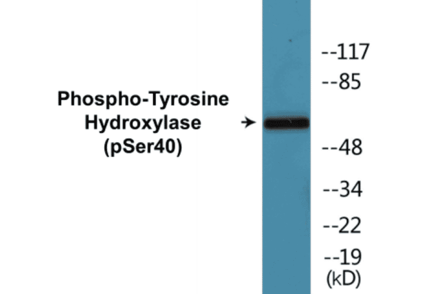 Western Blot - Tyrosine Hydroxylase (phospho Ser40) Cell Based ELISA Kit (CBP1037) - Antibodies.com