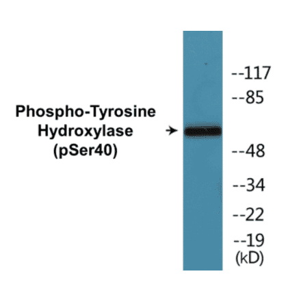 Western Blot - Tyrosine Hydroxylase (phospho Ser40) Cell Based ELISA Kit (CBP1037) - Antibodies.com