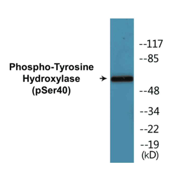 Western Blot - Tyrosine Hydroxylase (phospho Ser40) Cell Based ELISA Kit (CBP1037) - Antibodies.com