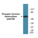 Western Blot - Tyrosine Hydroxylase (phospho Ser40) Cell Based ELISA Kit (CBP1037) - Antibodies.com