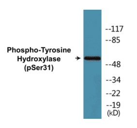 Western Blot - Tyrosine Hydroxylase (phospho Ser31) Cell Based ELISA Kit (CBP1036) - Antibodies.com