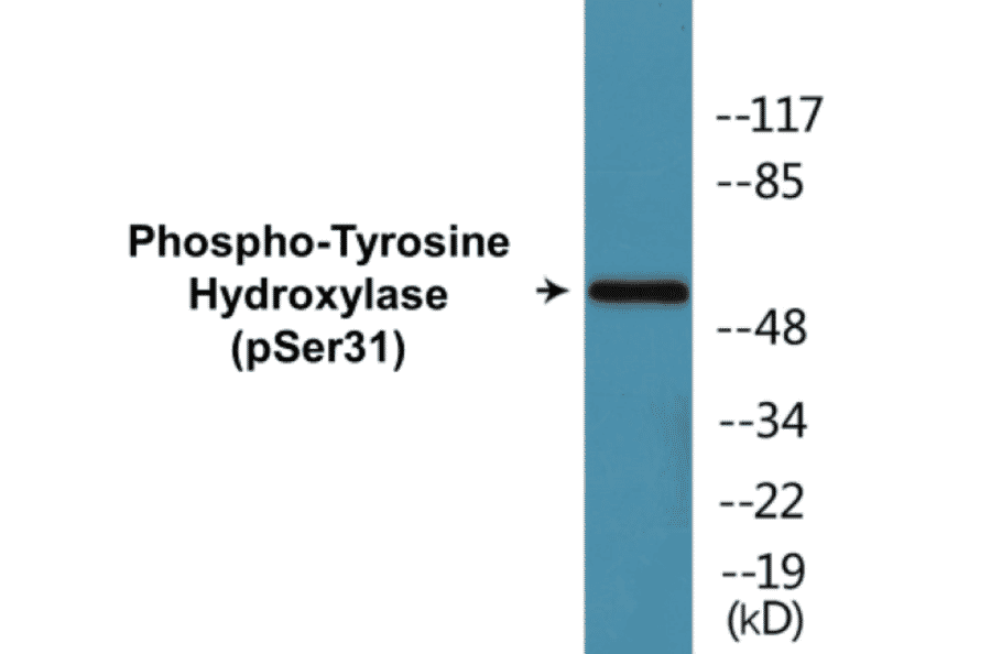 Western Blot - Tyrosine Hydroxylase (phospho Ser31) Cell Based ELISA Kit (CBP1036) - Antibodies.com