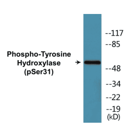 Western Blot - Tyrosine Hydroxylase (phospho Ser31) Cell Based ELISA Kit (CBP1036) - Antibodies.com