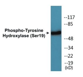 Western Blot - Tyrosine Hydroxylase (phospho Ser19) Cell Based ELISA Kit (CBP1035) - Antibodies.com