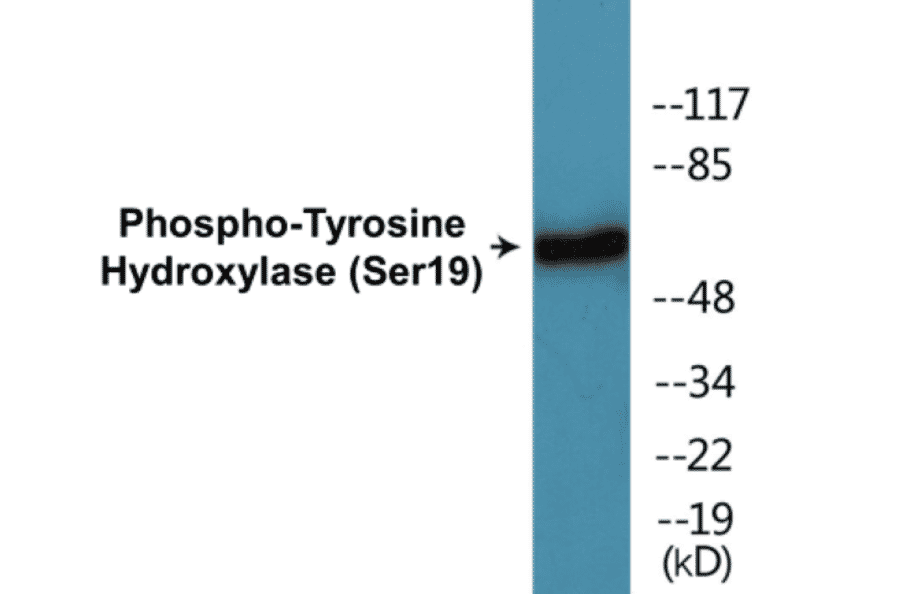 Western Blot - Tyrosine Hydroxylase (phospho Ser19) Cell Based ELISA Kit (CBP1035) - Antibodies.com