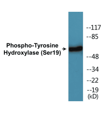Western Blot - Tyrosine Hydroxylase (phospho Ser19) Cell Based ELISA Kit (CBP1035) - Antibodies.com