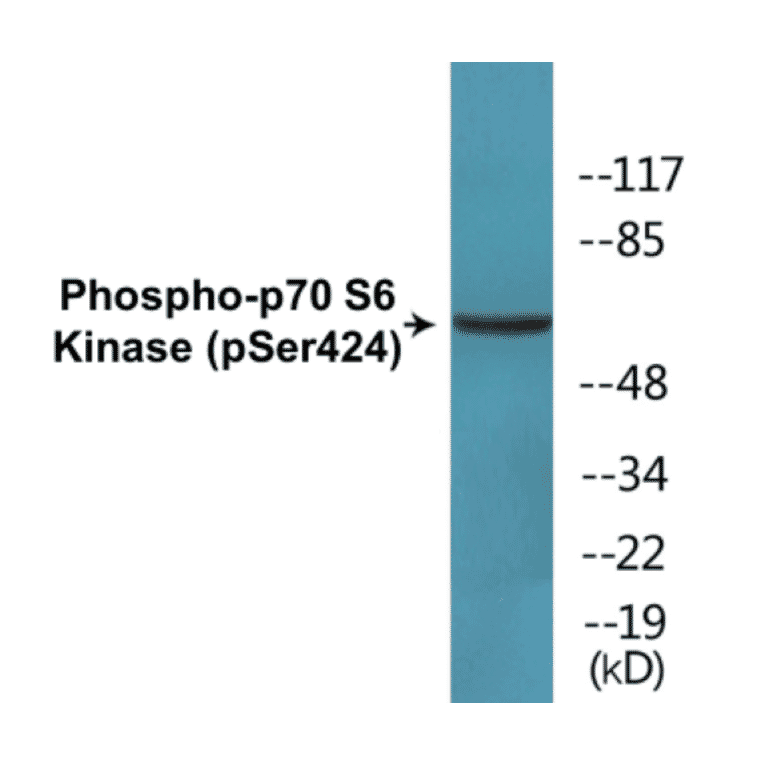 Western Blot - p70S6 Kinase (phospho Ser424) Cell Based ELISA Kit (CBP1651) - Antibodies.com