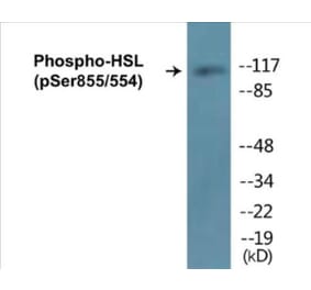 Western Blot - HSL (phospho Ser855 + Ser554) Cell Based ELISA Kit (CBP1067) - Antibodies.com