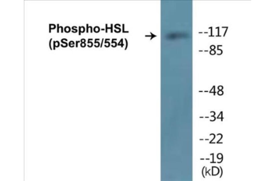 Western Blot - HSL (phospho Ser855 + Ser554) Cell Based ELISA Kit (CBP1067) - Antibodies.com