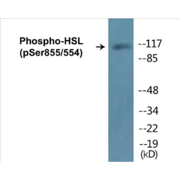 Western Blot - HSL (phospho Ser855 + Ser554) Cell Based ELISA Kit (CBP1067) - Antibodies.com