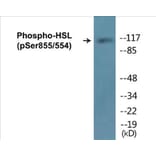 Western Blot - HSL (phospho Ser855 + Ser554) Cell Based ELISA Kit (CBP1067) - Antibodies.com