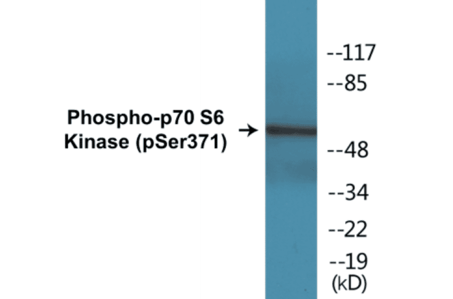 Western Blot - p70S6 Kinase (phospho Ser371) Cell Based ELISA Kit (CBP1190) - Antibodies.com