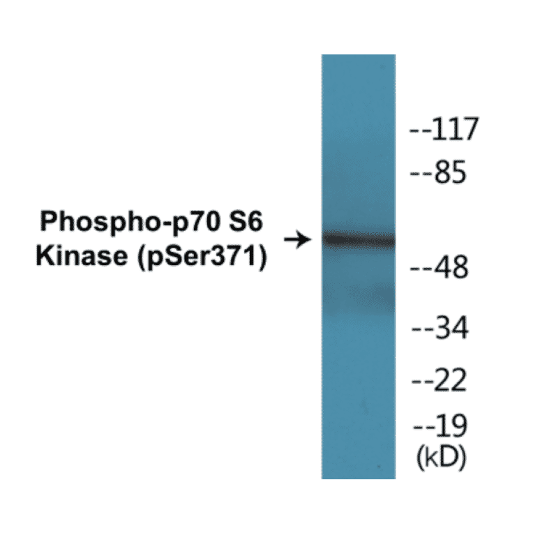 Western Blot - p70S6 Kinase (phospho Ser371) Cell Based ELISA Kit (CBP1190) - Antibodies.com