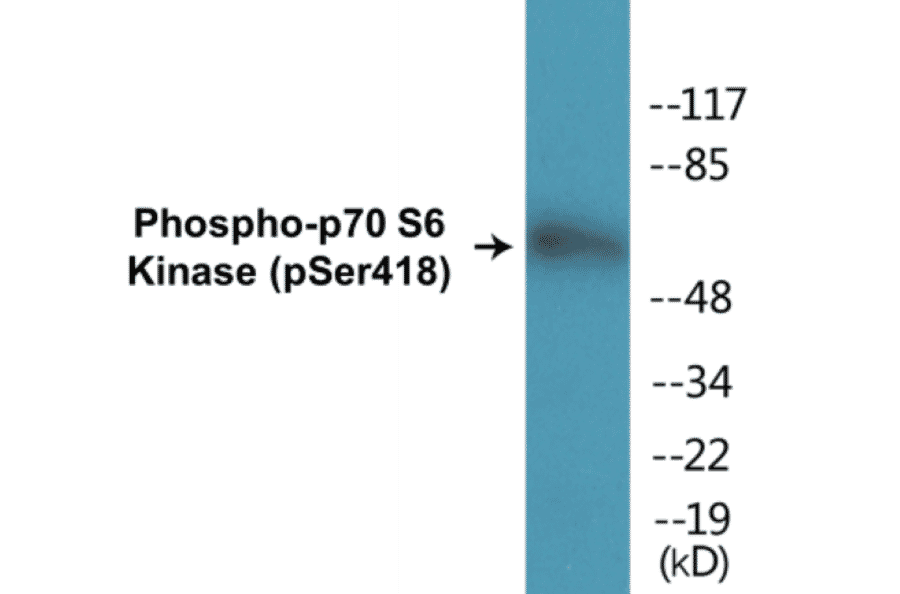 Western Blot - p70S6 Kinase (phospho Ser418) Cell Based ELISA Kit (CBP1192) - Antibodies.com