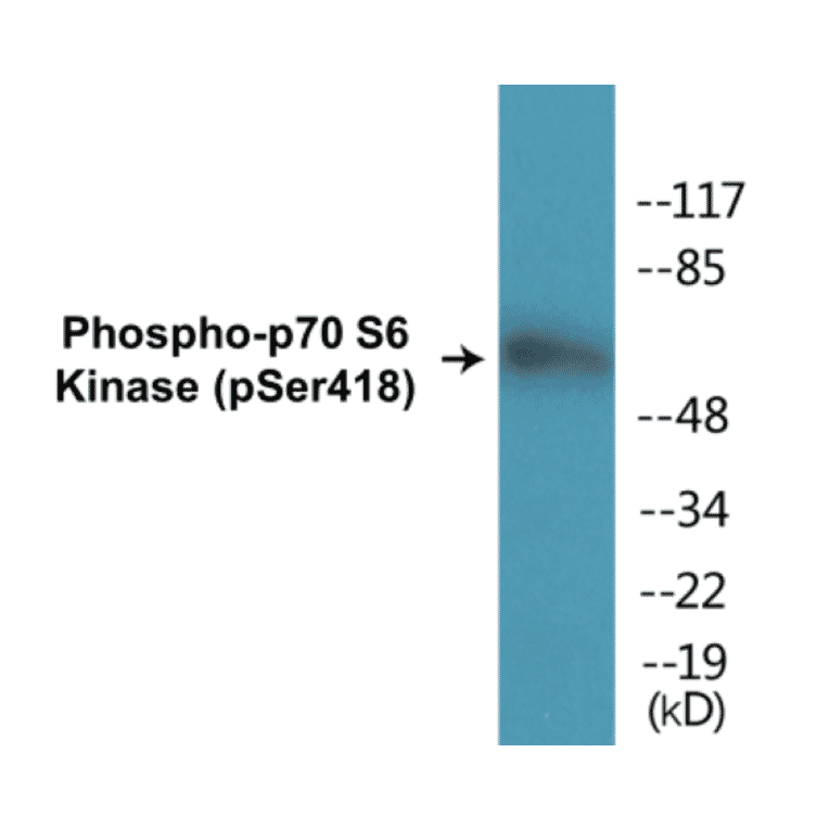 Western Blot - p70S6 Kinase (phospho Ser418) Cell Based ELISA Kit (CBP1192) - Antibodies.com