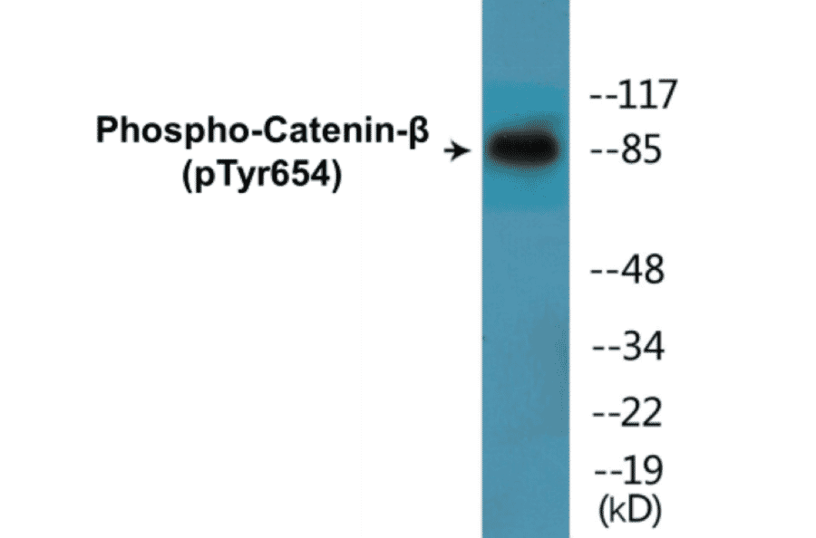 Western Blot - beta Catenin (phospho Tyr654) Cell Based ELISA Kit (CBP1335) - Antibodies.com