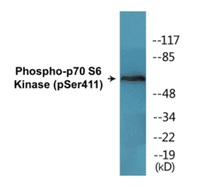 Western Blot - p70S6 Kinase (phospho Ser411) Cell Based ELISA Kit (CBP1650) - Antibodies.com