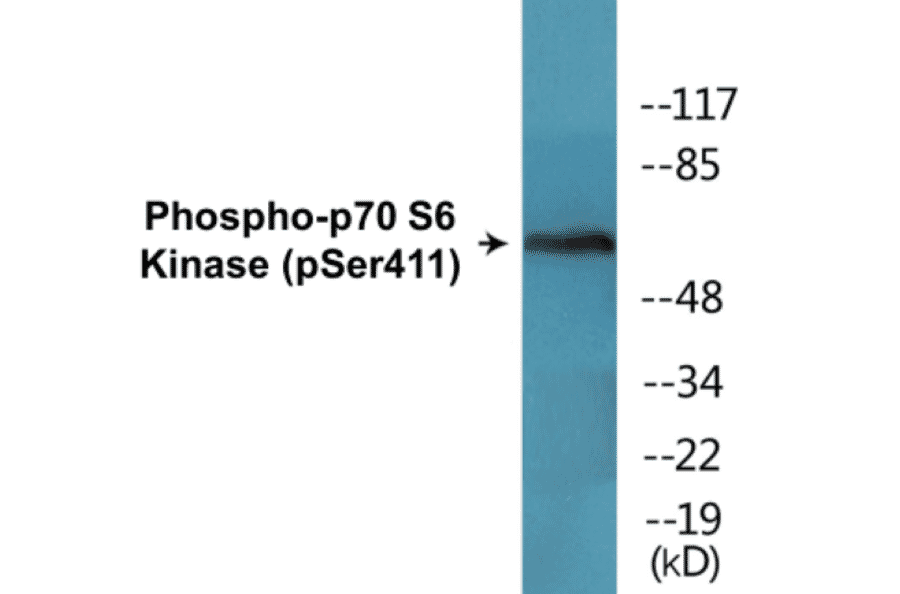 Western Blot - p70S6 Kinase (phospho Ser411) Cell Based ELISA Kit (CBP1650) - Antibodies.com