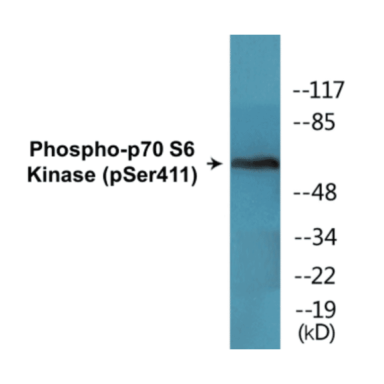 Western Blot - p70S6 Kinase (phospho Ser411) Cell Based ELISA Kit (CBP1650) - Antibodies.com