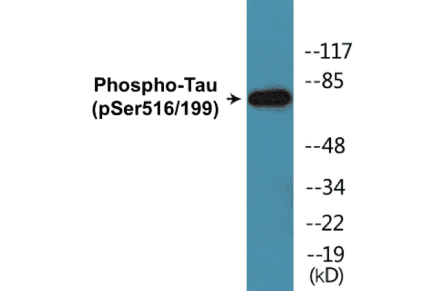Western Blot - Tau (phospho Ser516 + Ser199) Cell Based ELISA Kit (CBP1864) - Antibodies.com