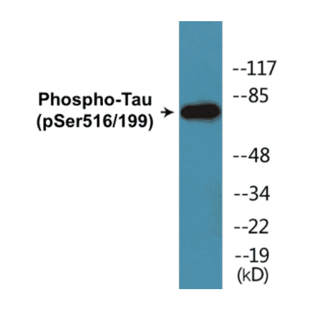 Western Blot - Tau (phospho Ser516 + Ser199) Cell Based ELISA Kit (CBP1864) - Antibodies.com