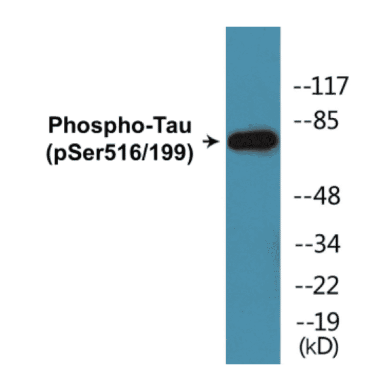 Western Blot - Tau (phospho Ser516 + Ser199) Cell Based ELISA Kit (CBP1864) - Antibodies.com