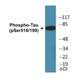 Western Blot - Tau (phospho Ser516 + Ser199) Cell Based ELISA Kit (CBP1864) - Antibodies.com
