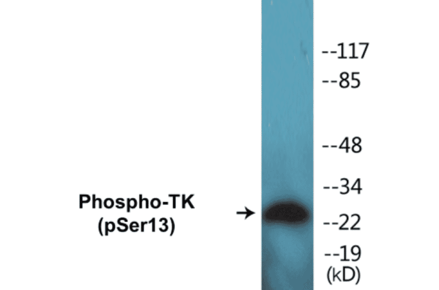 Western Blot - TK (phospho Ser13) Cell Based ELISA Kit (CBP1224) - Antibodies.com