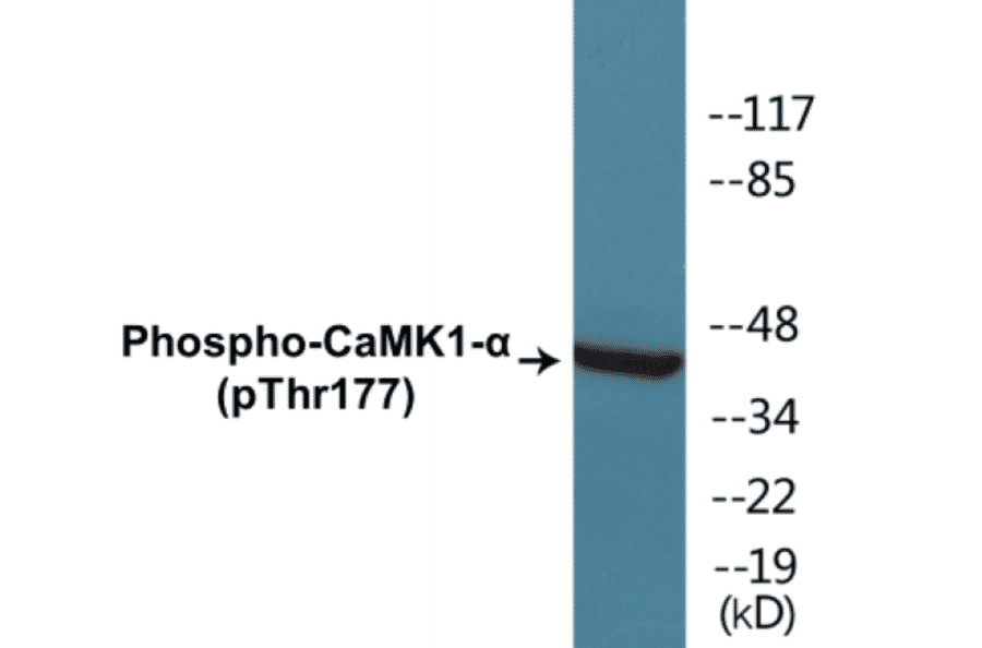 Western Blot - CaMK1 alpha (phospho Thr177) Cell Based ELISA Kit (CBP1328) - Antibodies.com