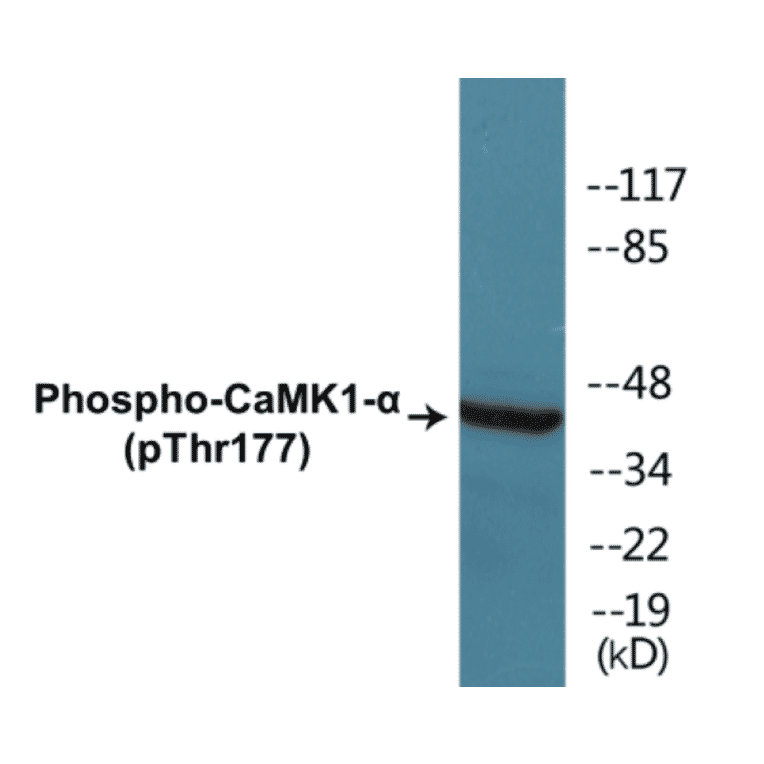 Western Blot - CaMK1 alpha (phospho Thr177) Cell Based ELISA Kit (CBP1328) - Antibodies.com