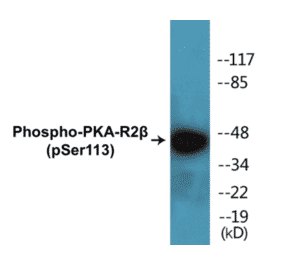 Western Blot - PKA-R2 beta (phospho Ser113) Cell Based ELISA Kit (CBP1388) - Antibodies.com