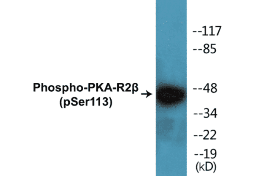 Western Blot - PKA-R2 beta (phospho Ser113) Cell Based ELISA Kit (CBP1388) - Antibodies.com