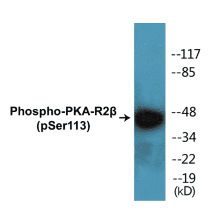 Western Blot - PKA-R2 beta (phospho Ser113) Cell Based ELISA Kit (CBP1388) - Antibodies.com