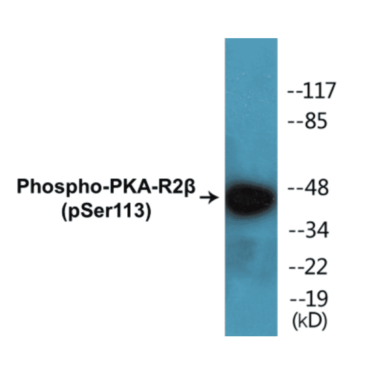 Western Blot - PKA-R2 beta (phospho Ser113) Cell Based ELISA Kit (CBP1388) - Antibodies.com