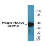 Western Blot - PKA-R2 beta (phospho Ser113) Cell Based ELISA Kit (CBP1388) - Antibodies.com
